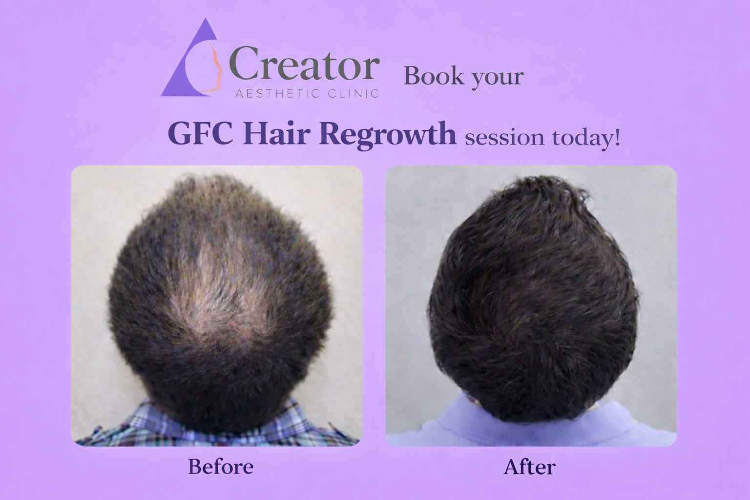 GFC Hair Therapy result